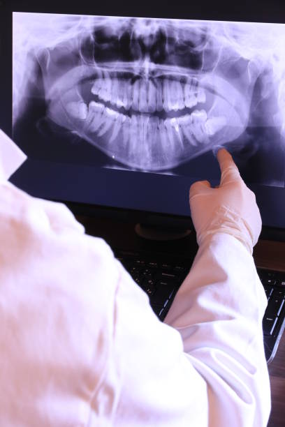 Best Emergency Root Canal Treatment in North Adams, MA